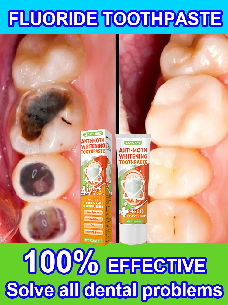 Teeth Whitening Treatment - Repair tooth decay and whiten toothpaste