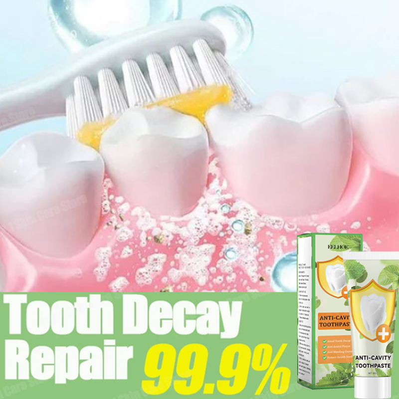 Teeth Whitening Treatment - Anti Decay Toothpaste repairs cavities, removes
