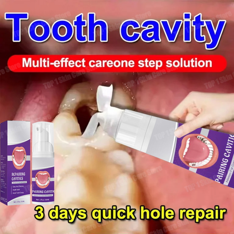 Teeth Whitening Treatment - Hot sales Best-selling, Scientific Repairs Cavities,