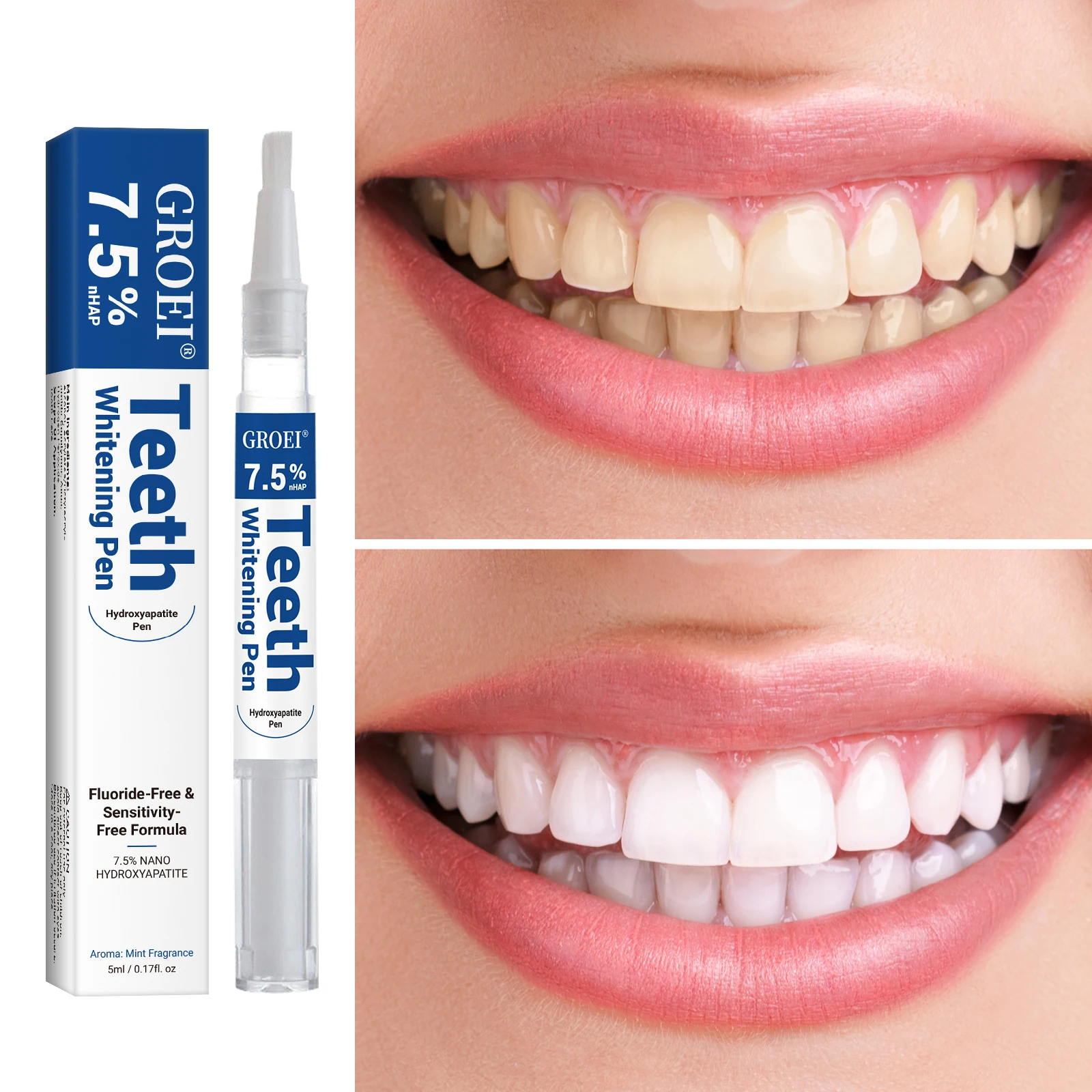Hydroxyapatite Tooth Whitening - Teeth Whitening Results reseña y precio