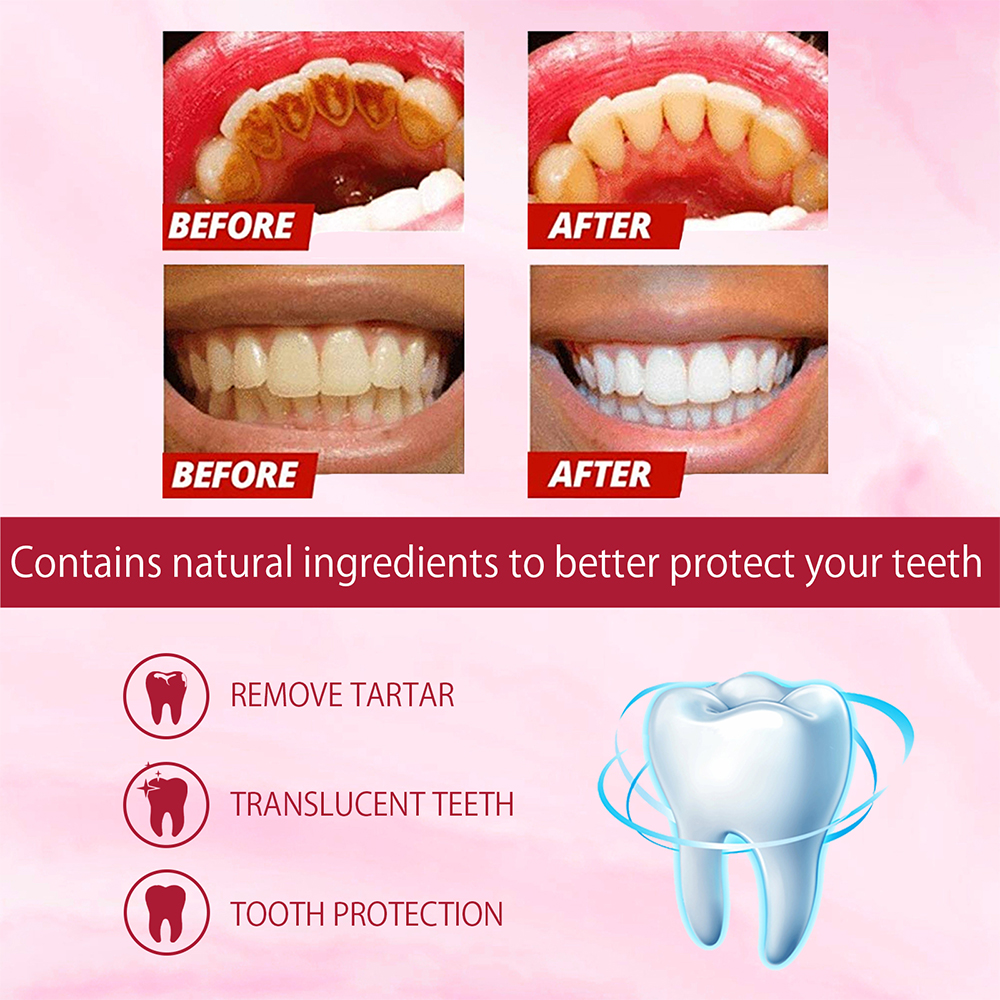 SP-4 Probiotic Whitening Tooth - Teeth Whitening Enzymes reseña y precio