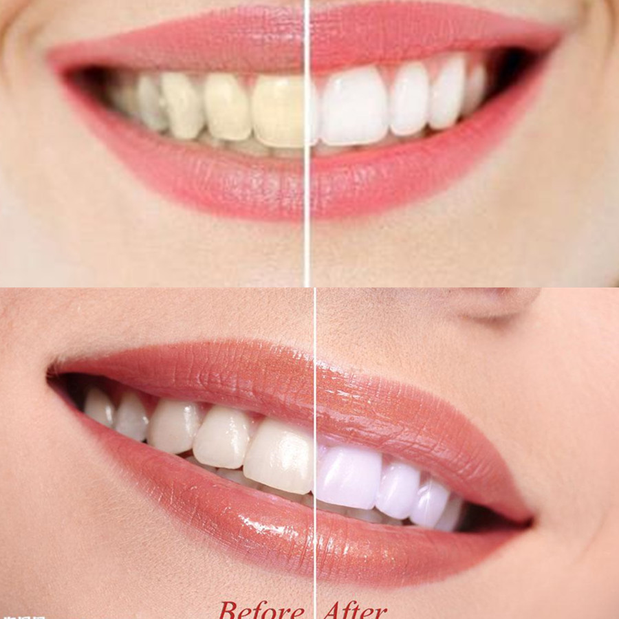 Bamboo Charcoal Teeth Tooth De - Teeth Whitening Quotes reseña y precio