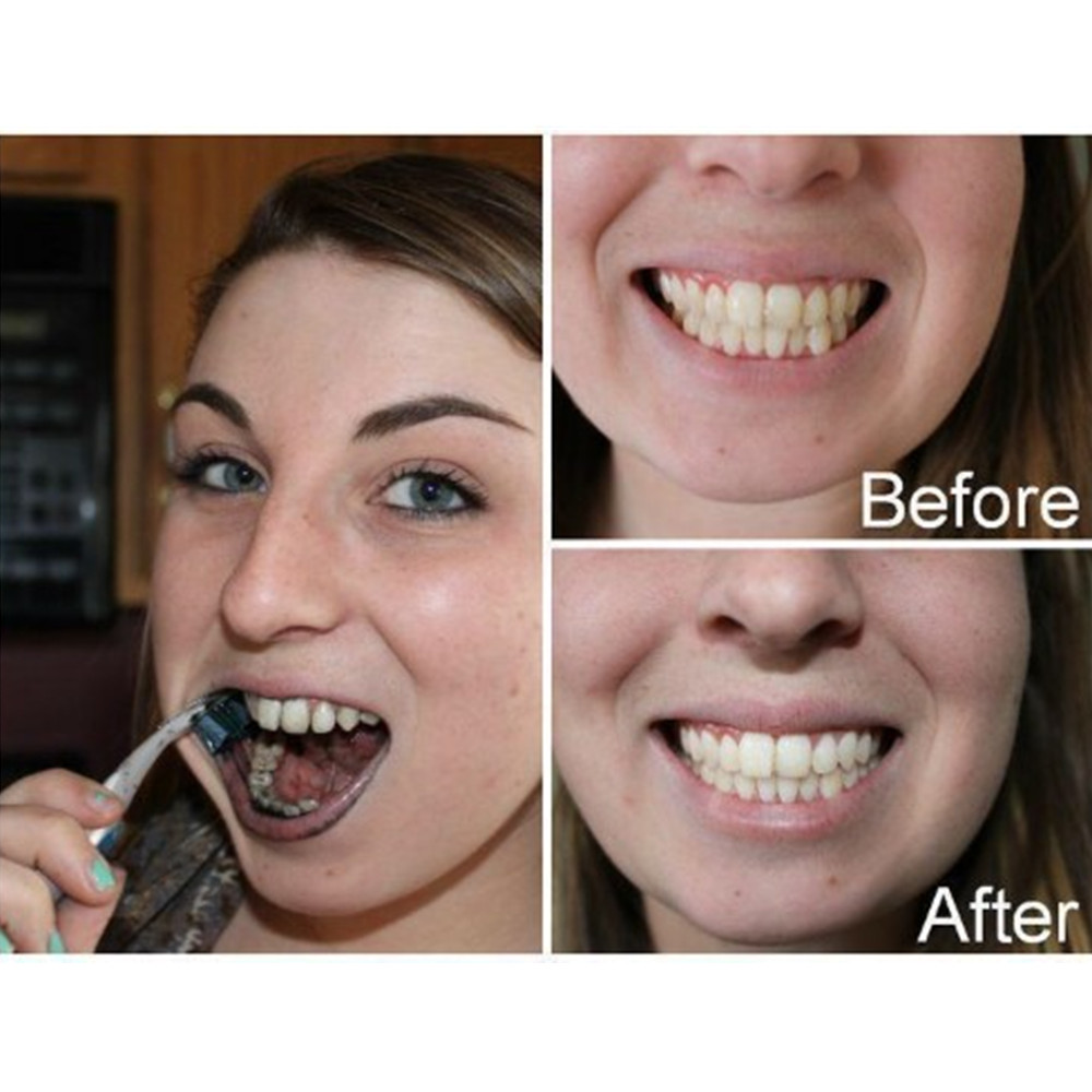 Bamboo Charcoal Teeth Tooth De - Teeth Whitening Quotes reseña y precio