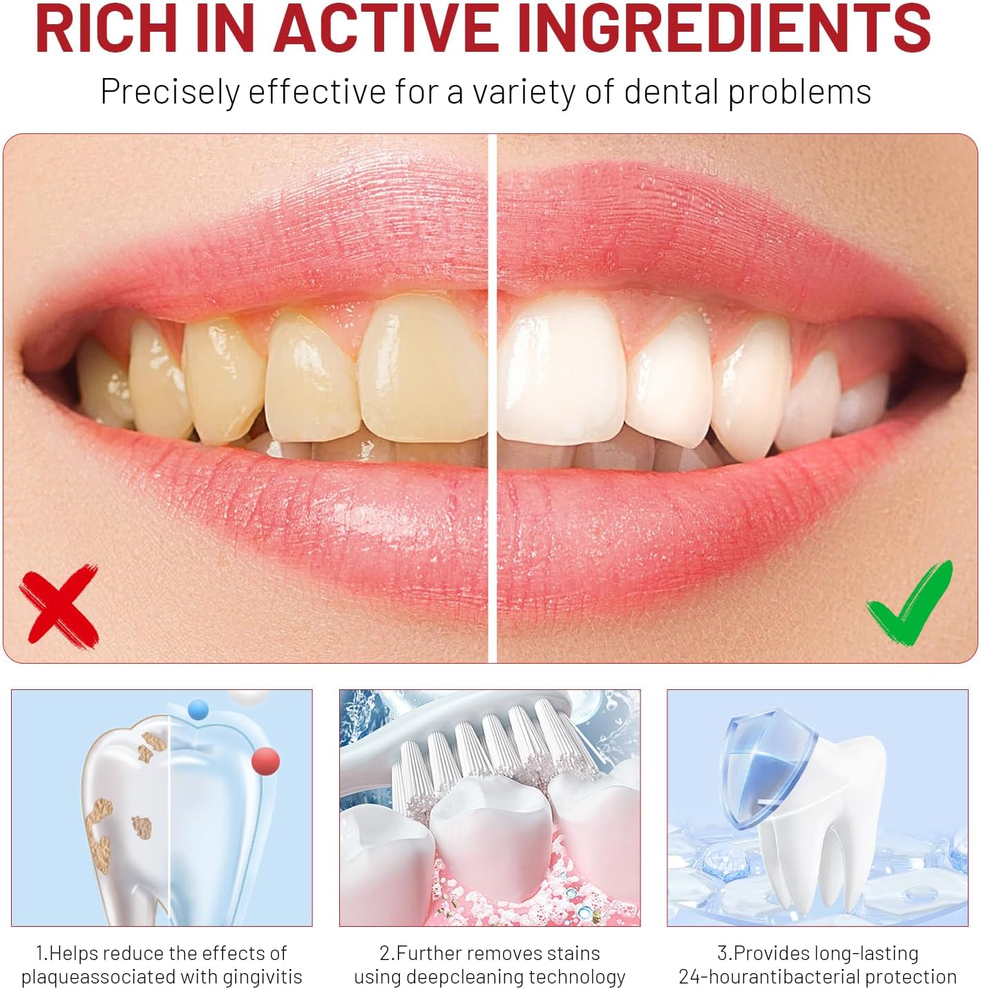 Niacinamide Whitening Toothpas - Teeth Whitening Treatment reseña y precio