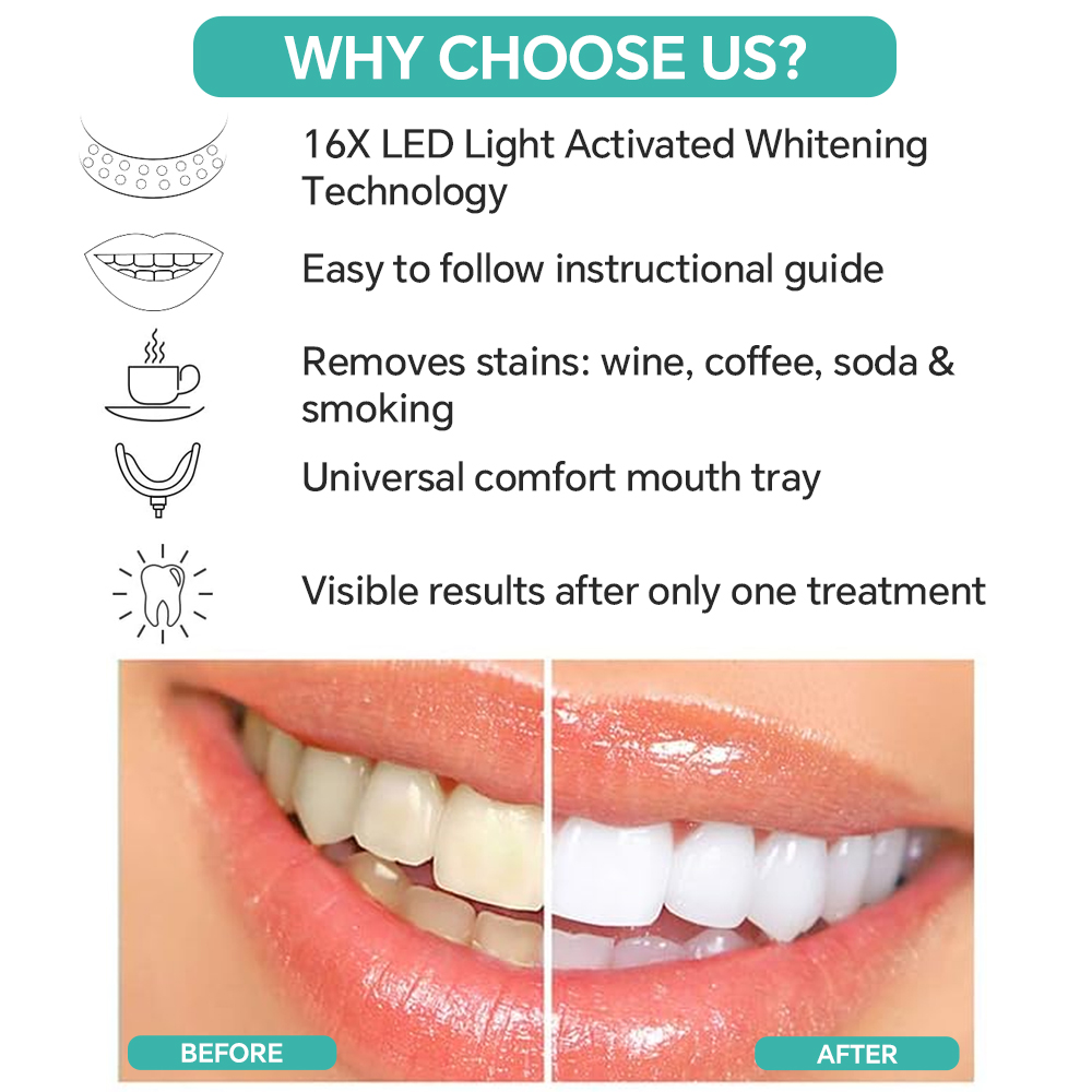 Teeth Whitening Accelerator Li - Teeth Whitening Accelerator reseña y precio