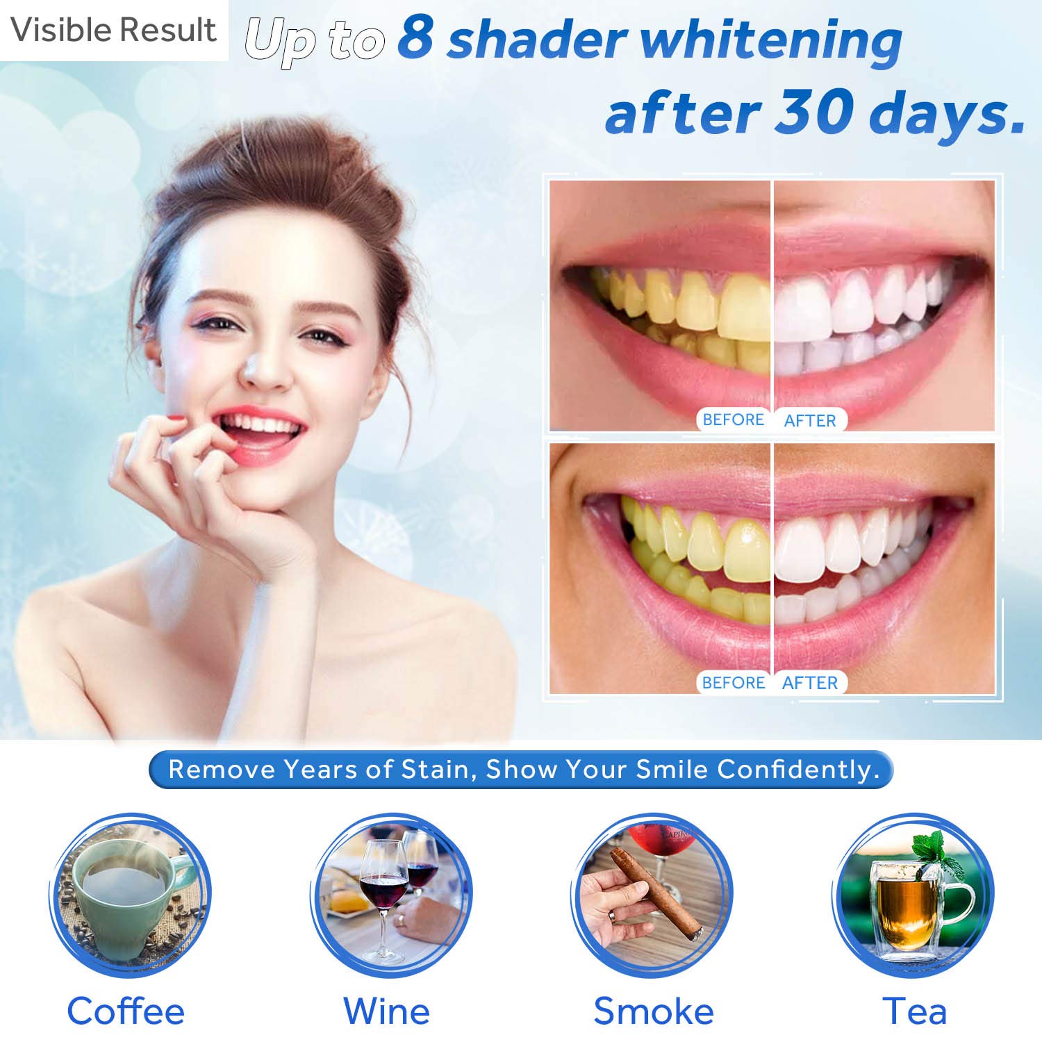Teeth Whitening Gel Refill Syr - Teeth Whitening Q&M reseña y precio