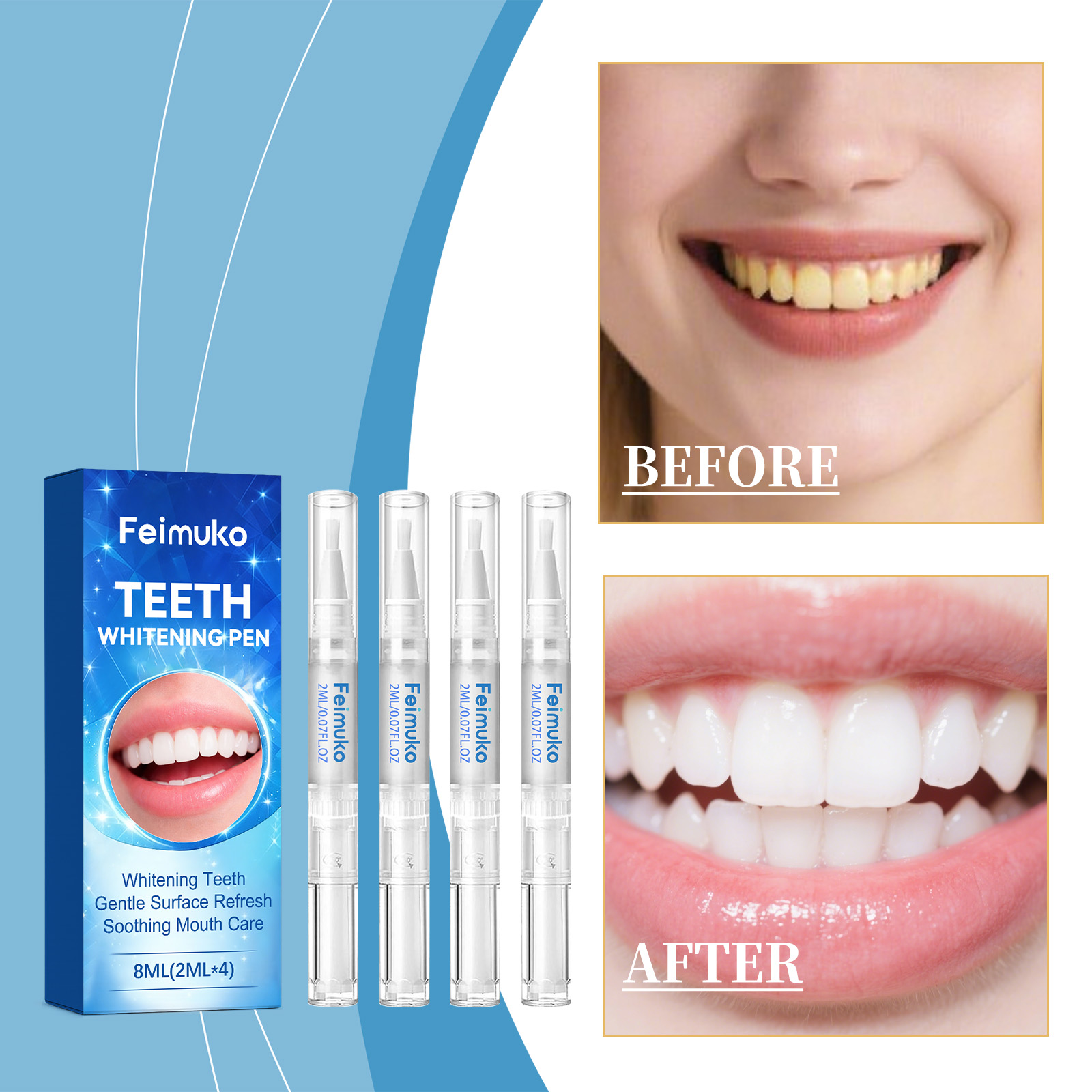 Feimuko 8ml Teeth Gel Pen Gent - Teeth Whitening Q&M reseña y precio