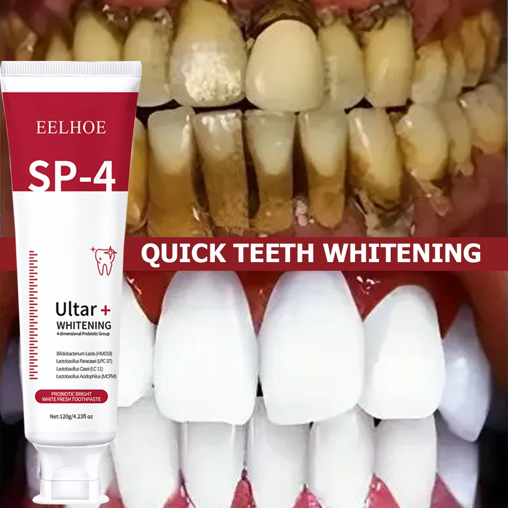 5pcs Sp-4 120g Probiotic White - Teeth Whitening Enzymes reseña y precio
