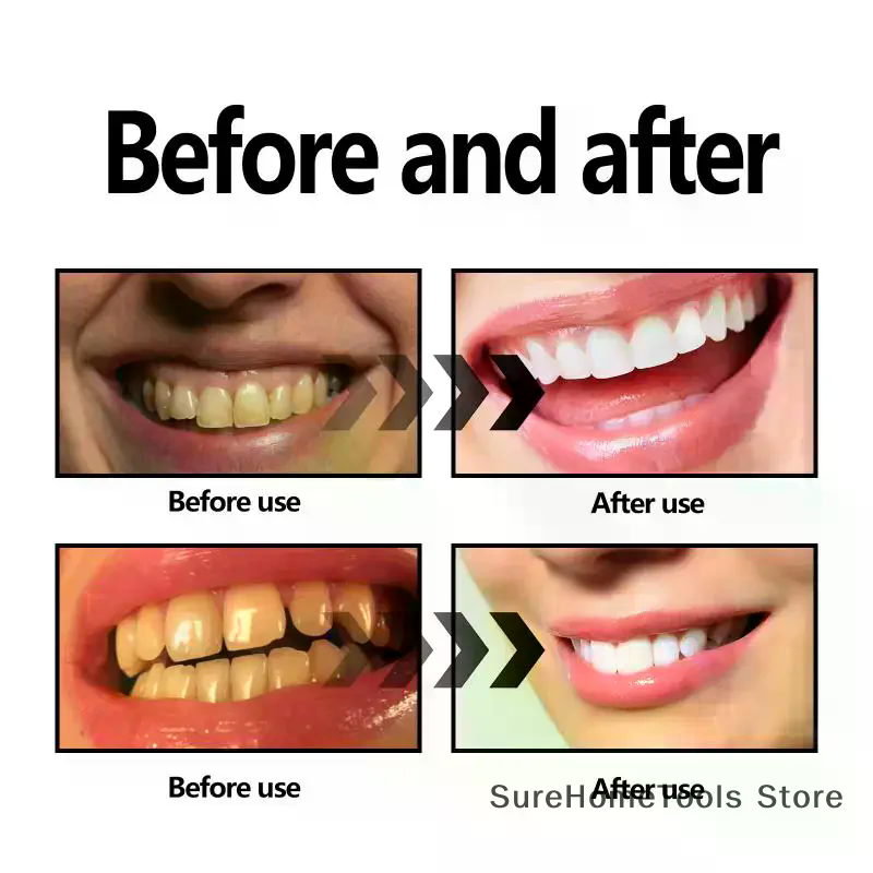 Bamboo Charcoal Powder For Tee - Teeth Whitening Quotes reseña y precio