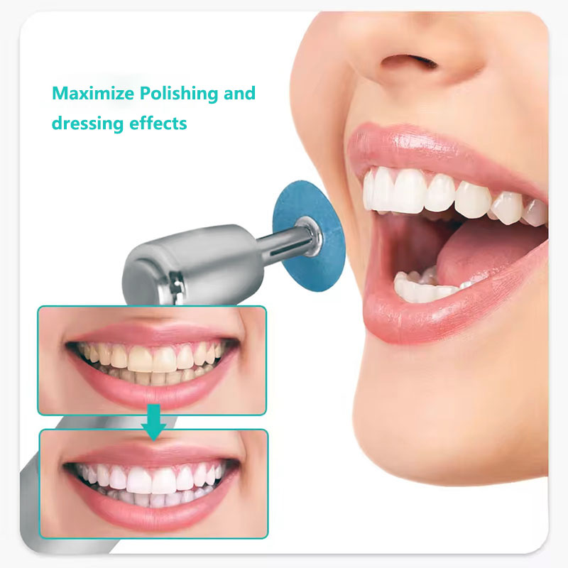 40pcs Dental Polishing Discs H - Teeth Whitening Home reseña y precio