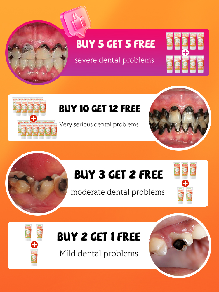 Repair tooth decay and whiten  - Teeth Whitening Treatment reseña y precio