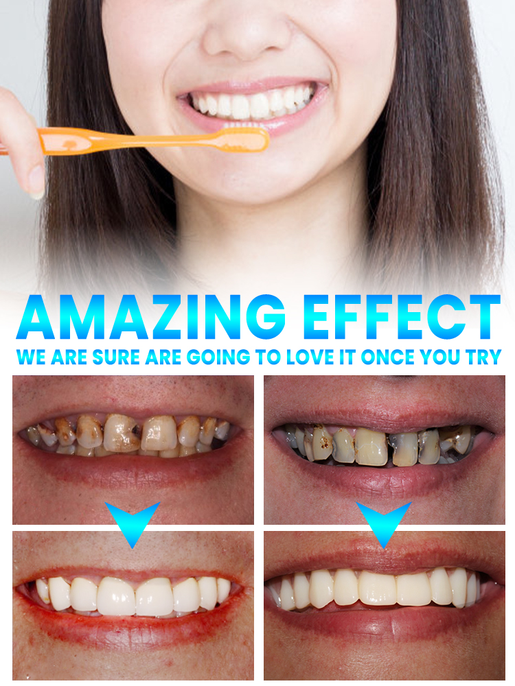 Repair tooth decay and whiten  - Teeth Whitening Treatment reseña y precio