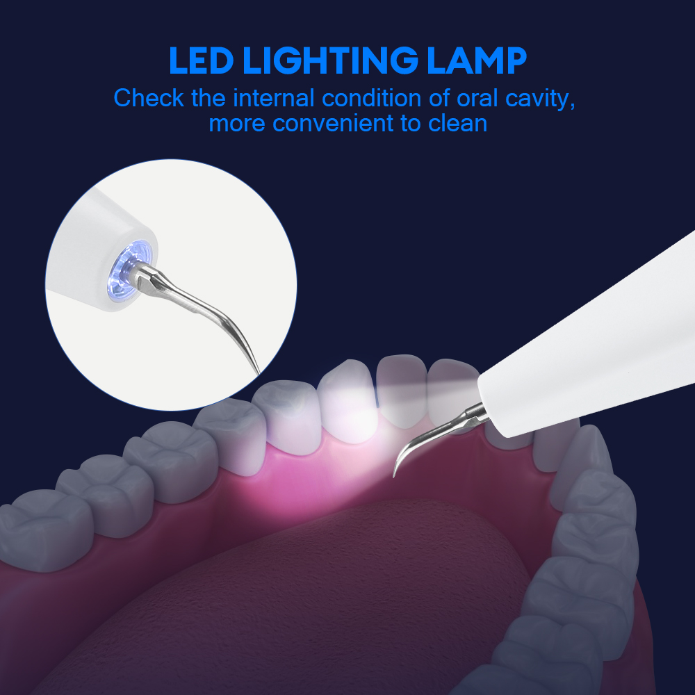 Ultrasonic Dental Calculus Rem - Teeth Whitening Home reseña y precio