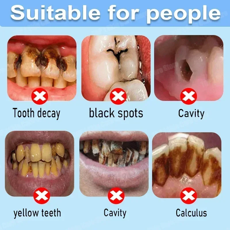 Anti Decay Toothpaste repairs  - Teeth Whitening Treatment reseña y precio