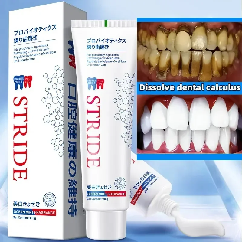 Dental Calculus Remover Remova - Teeth Whitening Treatment reseña y precio
