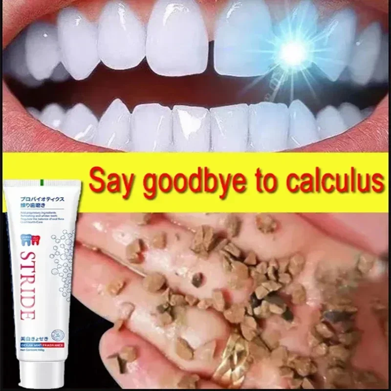 Dental Calculus Remover Remova - Teeth Whitening Treatment reseña y precio
