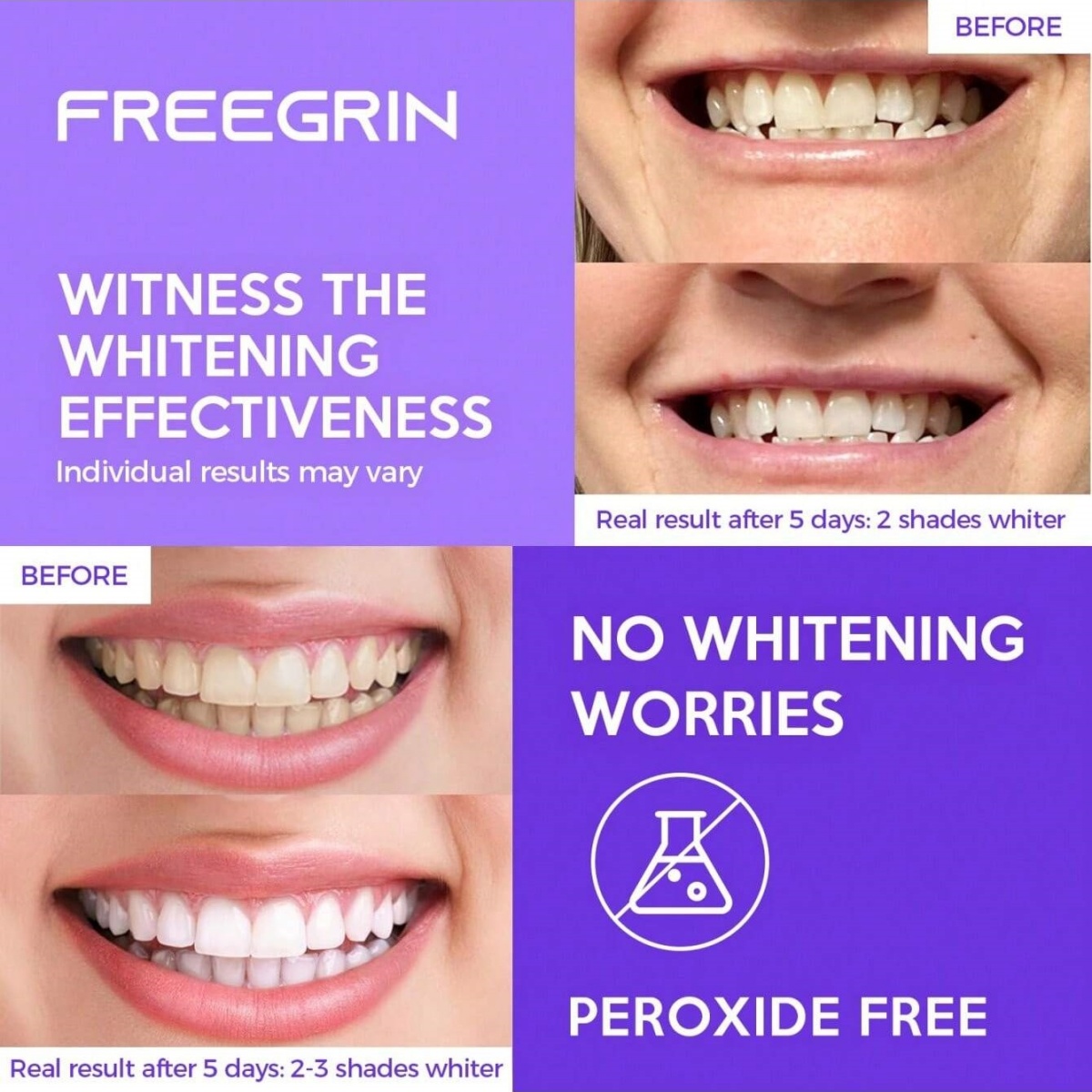 Deluxe Whitening Teeth Sticker - Teeth Whitening Quotes reseña y precio