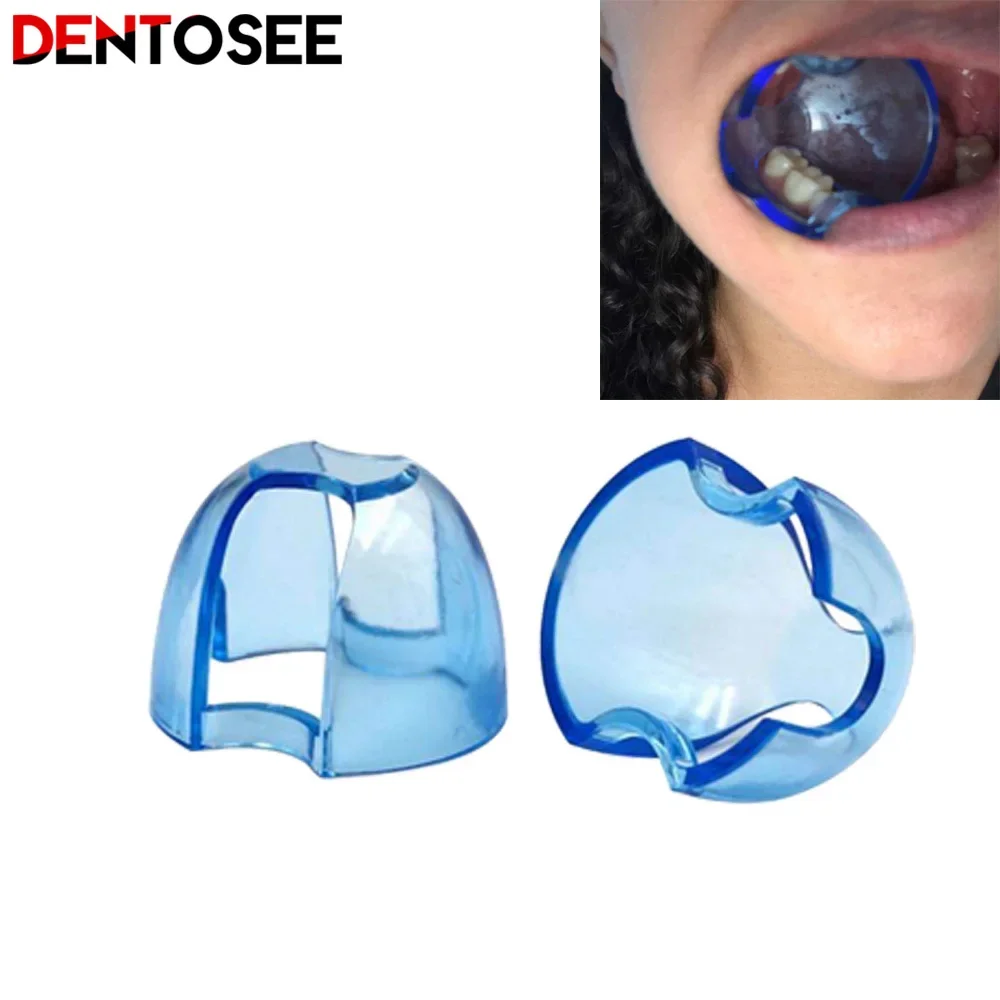 Dental Intraoral Cheek Retract - Teeth Whitening Accelerator reseña y precio
