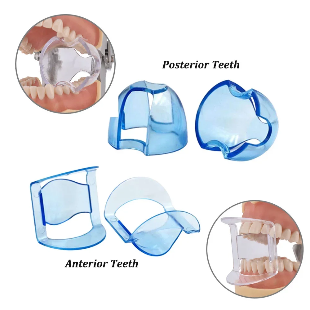 Dental Intraoral Cheek Retract - Teeth Whitening Accelerator reseña y precio