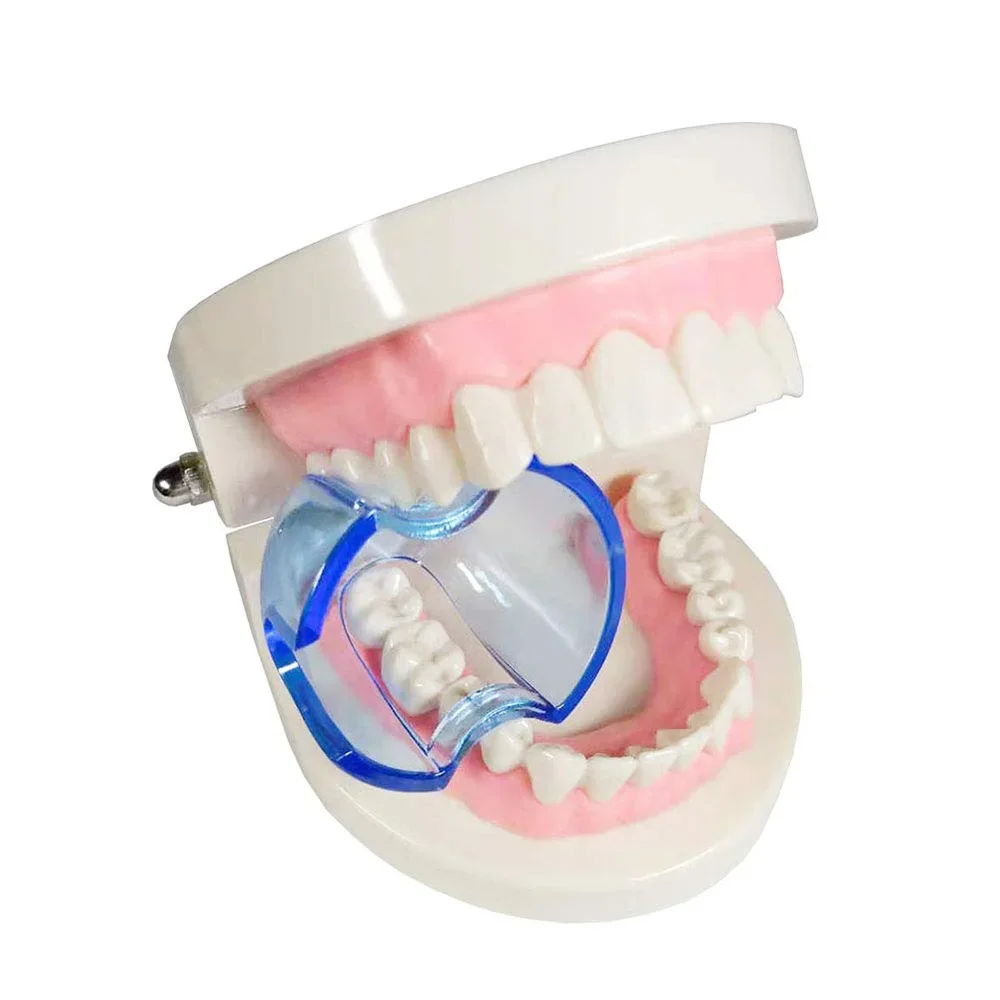 Dental Intraoral Cheek Retract - Teeth Whitening Accelerator reseña y precio