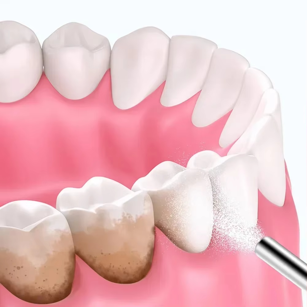 Dental Sandblasting Powder 500 - Teeth Whitening Quotes reseña y precio
