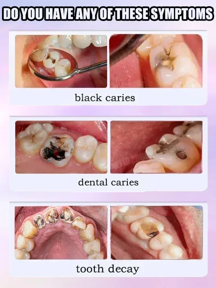 Teeth Cleaning Toothpaste Remo - Teeth Whitening Treatment reseña y precio