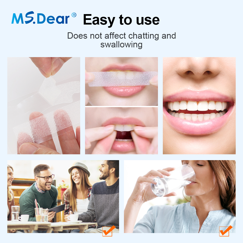 Teeth Whitening Strips Cleansi - Teeth Whitening Quotes reseña y precio